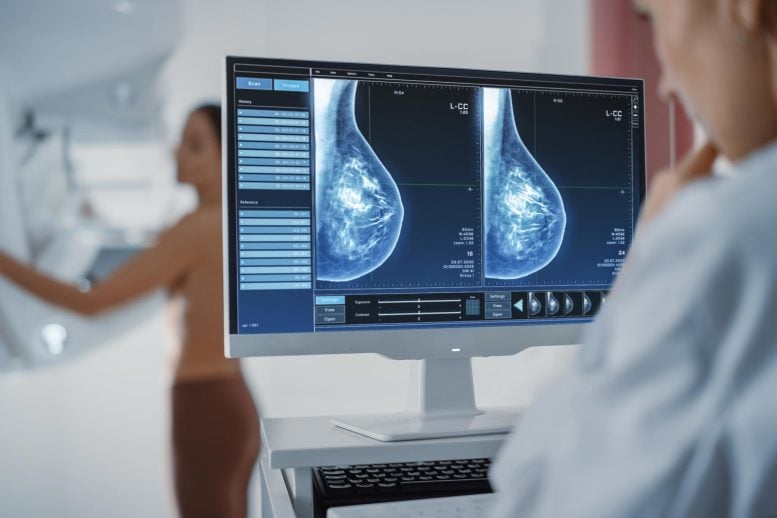Computer Screen Breast Cancer Mammography Screening Procedure