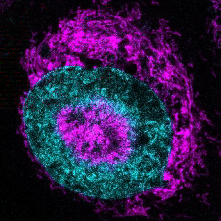 Confined Cancer Cell