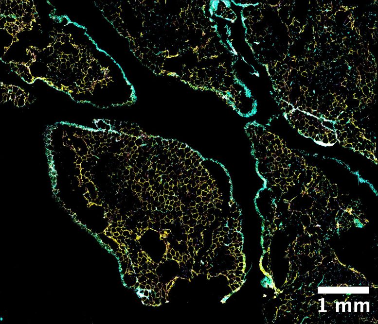 מיקרוסקופיה קונפוקלית תמונות פלורסנט של רקמת שומן אומנטלית אנושית