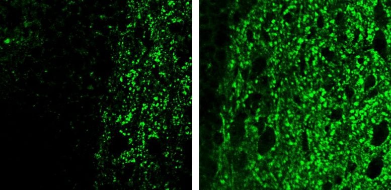 Connections Between Nerve Cells in the Brain Alzheimer&rsquo;s