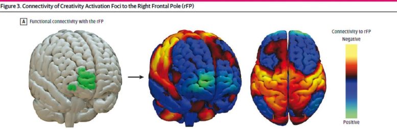 Connectivity of Creativity Activation Foci to Right Frontal Pole
