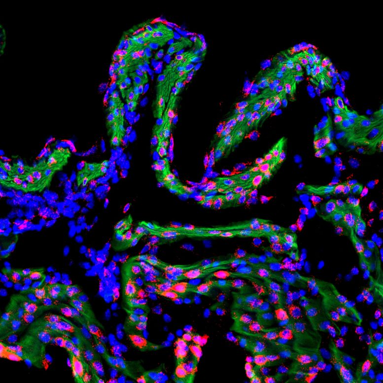 Connexin 43 Expression in Late Pregnancy Mouse Uterus