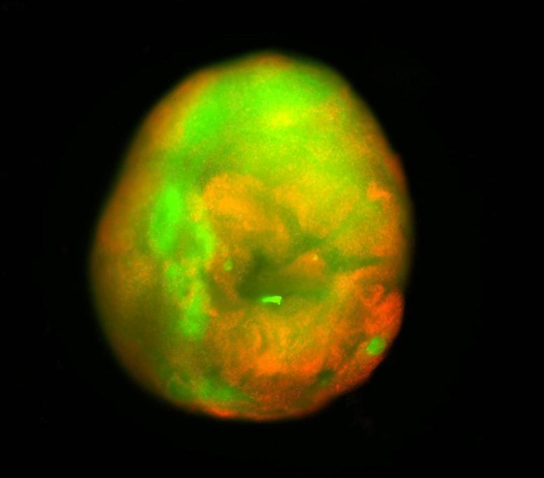 Modello di contusione