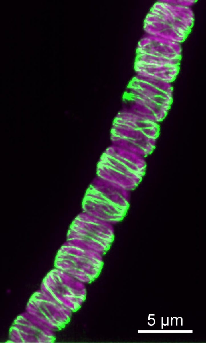 CorM Filaments in Anabaena