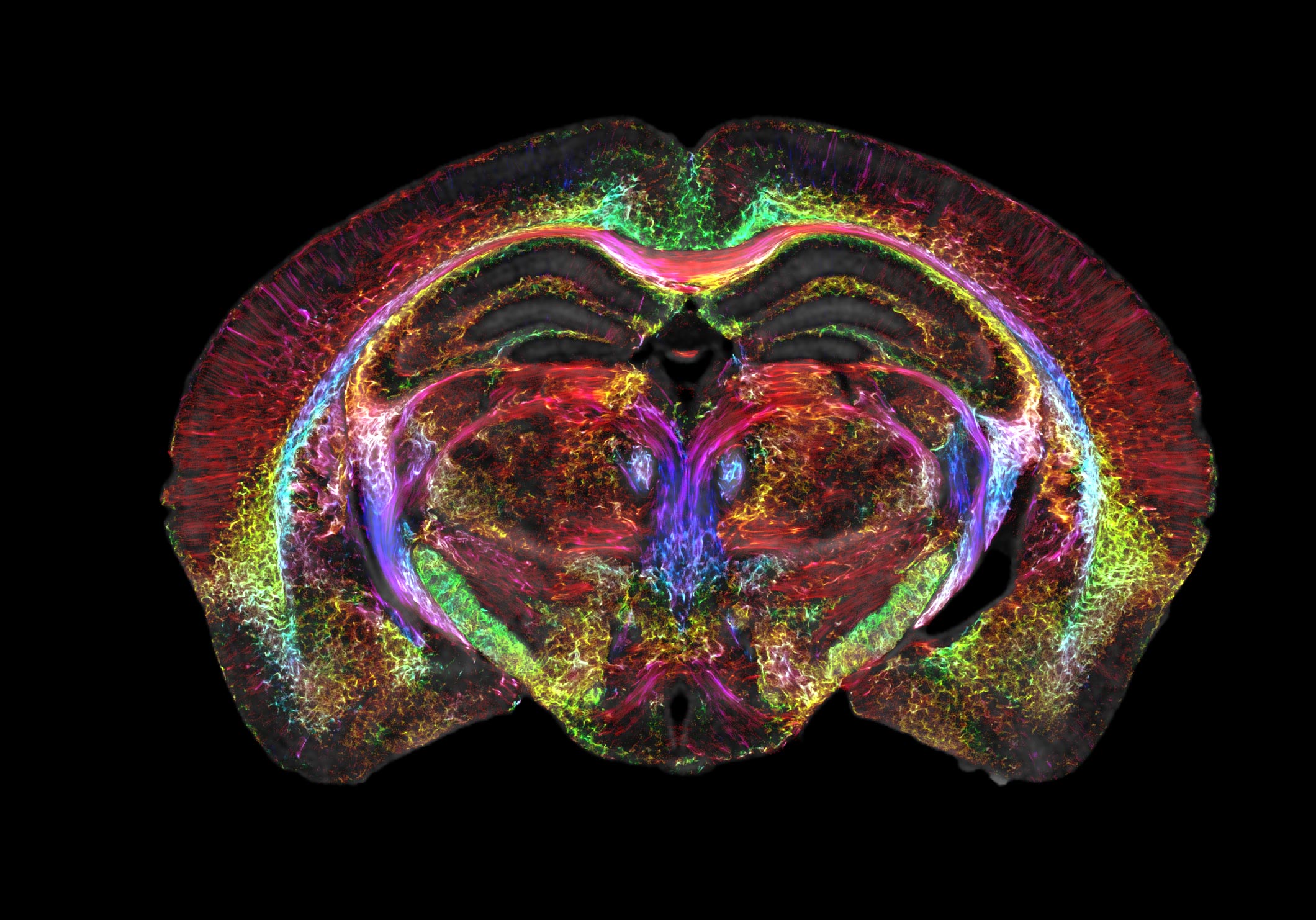 Brain Imaging Breakthrough: 64 Million Times Sharper