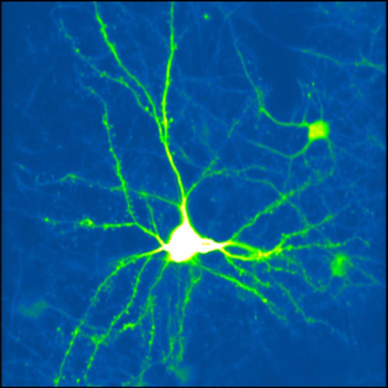 Cortical Neuron Expressing Green Fluorescent Protein