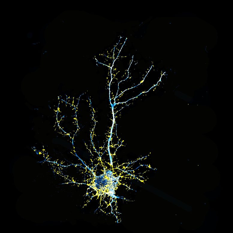 Cortical Neuron Treated With JRT