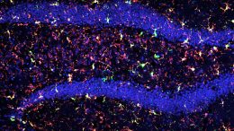 Cosmic Radiation Modifies Phagocytic Activity and Prevents Cognitive Deficits