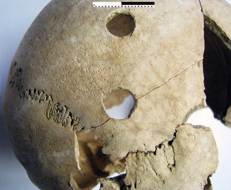 Cracked Skull of Young Adult Female