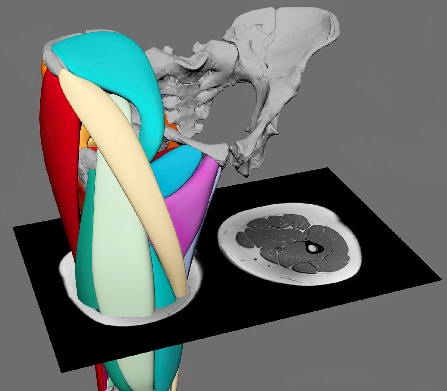 La reconstrucción muscular en 3D revela que ‘Lucy’ de 3,2 millones de años podría pararse como los humanos modernos