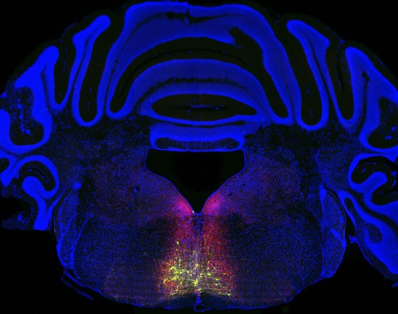 Cross Section of a Mouse Brain Showing Neurons Involved in Chronic Pain and Acute Pain