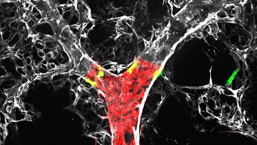 Crosstalk Between Cells Plays Role in Pulmonary Hypertension