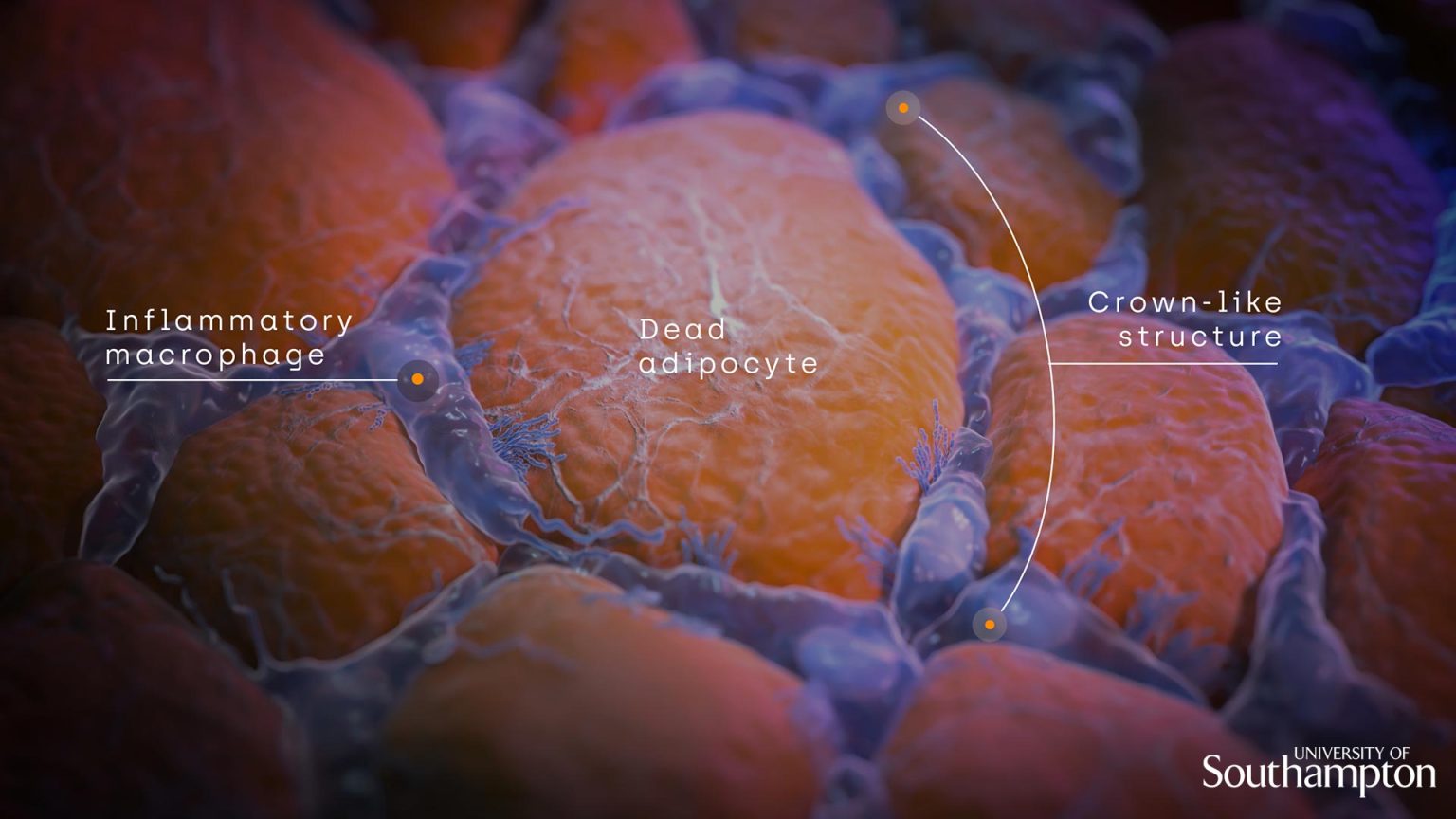 Scientists Discover “CrownLike Structures” Surrounding Breast Tumors