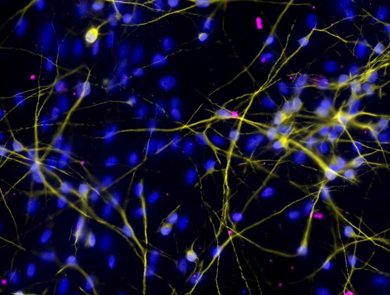 נוירונים אנושיים מתורבתים הנגועים ב-ZIKV LAV