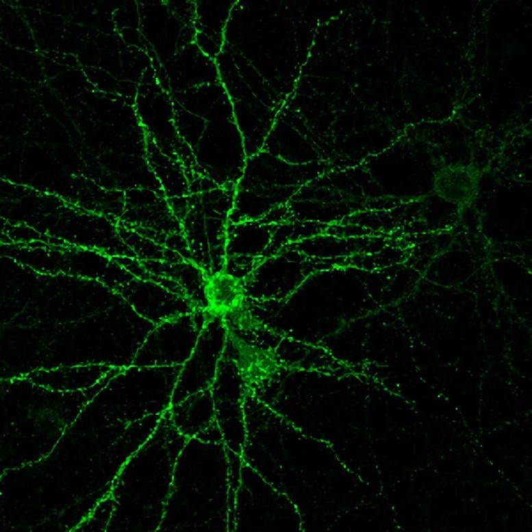 Cultured Neuron With Projecting Dendrites