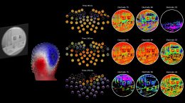 DETI Mapping Results From the Brain