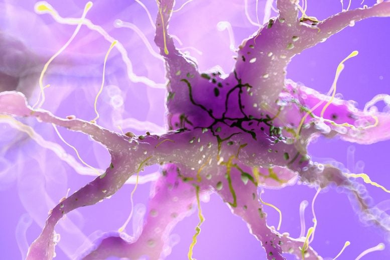 Damaged Neuron Brain Nerve Cell