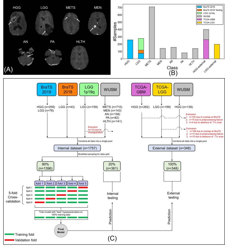 Deep Learning Model Classifies Brain Tumors Single MRI Scan