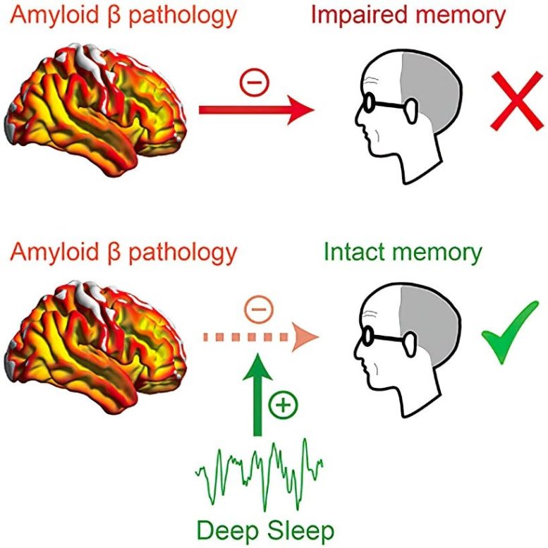 Deep Sleep and Alzheimer’s Disease Pathology