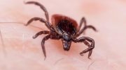Deer Tick on Skin Lyme Disease