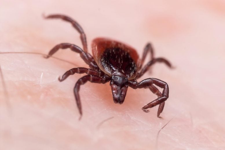 Deer Tick on Skin Lyme Disease