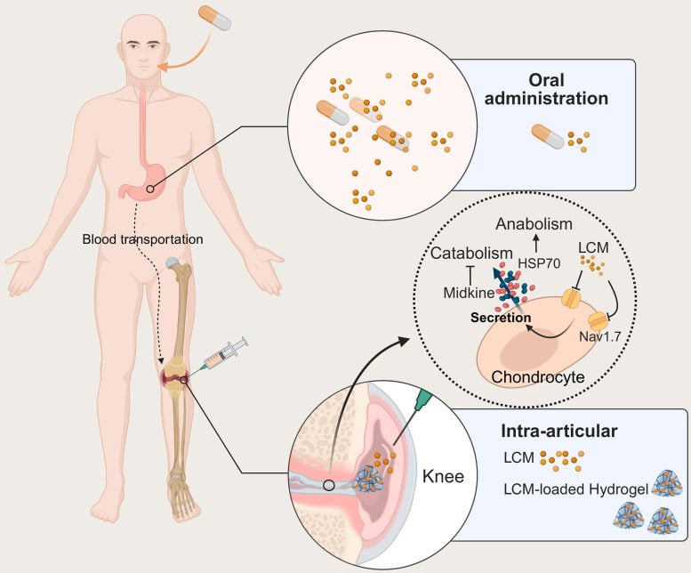 Delivery Routes and Cartilage Protective Mechanisms of LCM in Osteoarthritis