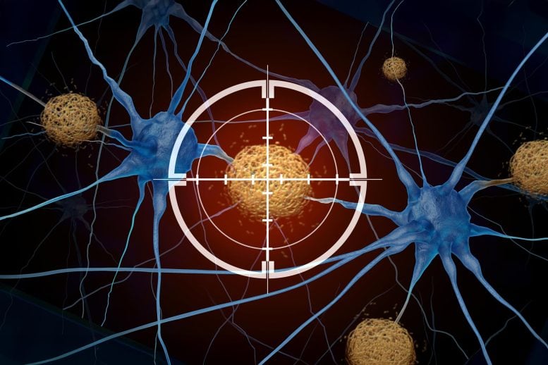 Dementia Treatment Tau Tangles Amyloid Beta Therapy Target