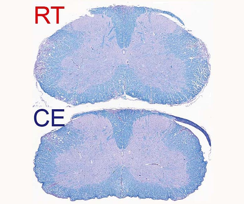 Demyelinated Spinal Cord of Mice Suffering From Autoimmune Disease