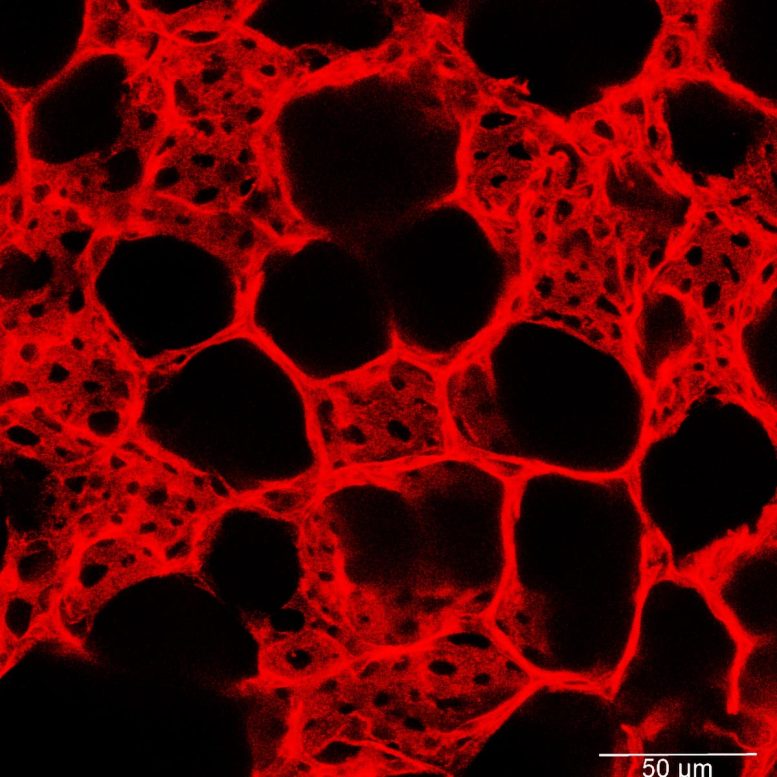 Dense Network of Capillary Blood Vessels in the Lung