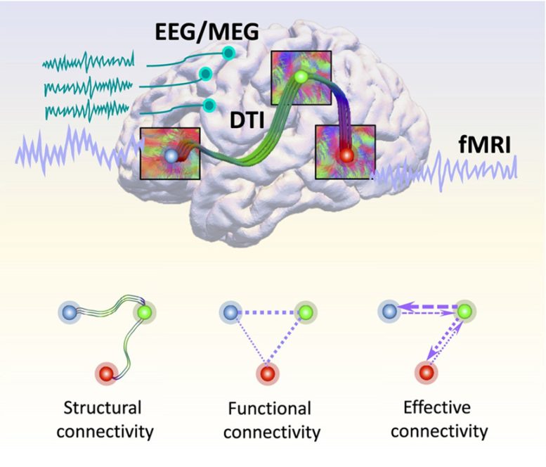 Depictions of Connections in a Brain Connectome and the Resulting Three Types of Connectivity