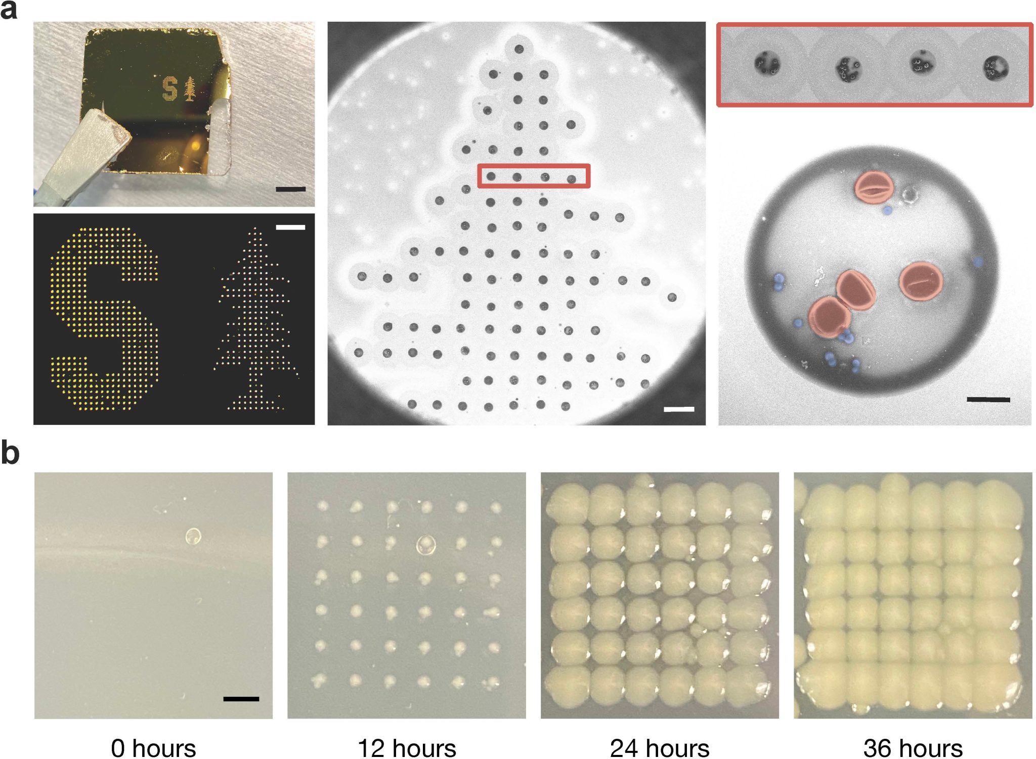 Stanford Researchers Develop a Faster, Cheaper Way To Spot Bacteria in ...