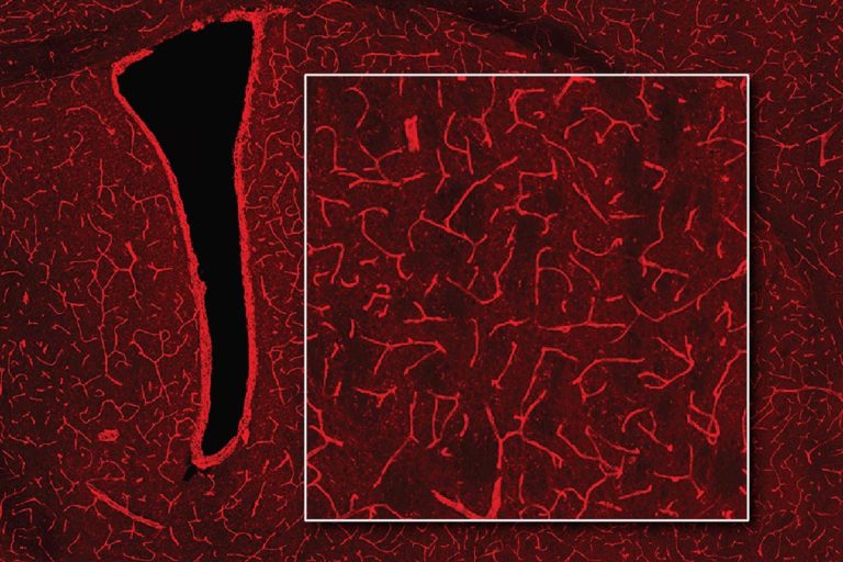 Mit Scan Brain MIT’s New MRI Technique Reveals Hidden Light Deep in the Brain ...