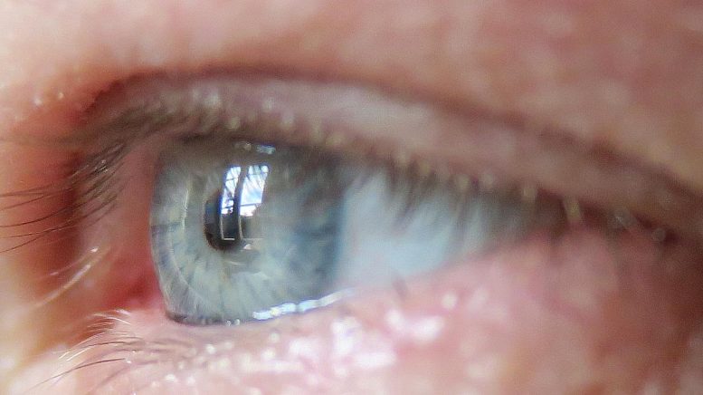 Diabetes Eye Implant