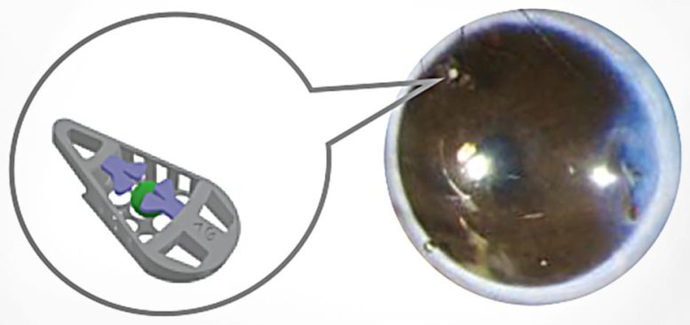 Diabetes Eye Implant Microdevice