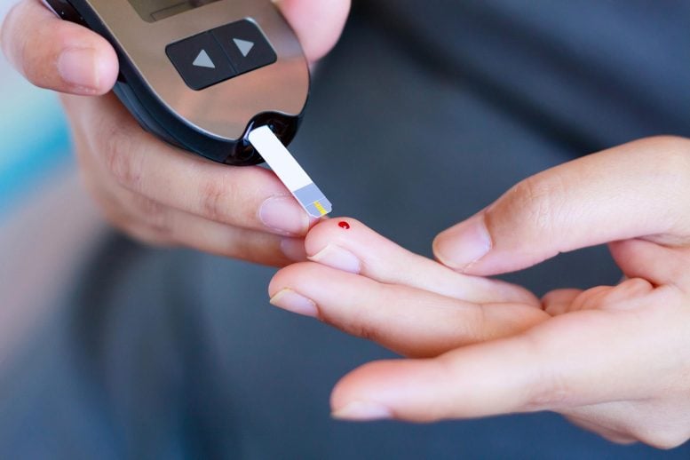 Diabetes Glucose Blood Test