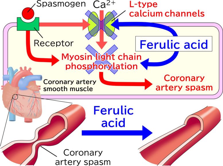 Diagram Showing How Ferulic Acid Prevents Coronary Artery Spasms