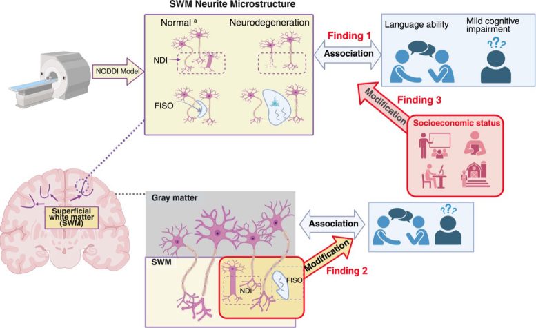 Diagram of Brain Microstructure