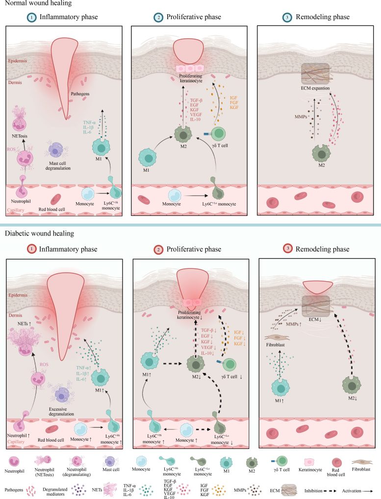 Diagram of the Immune Cell Distribution and Function During Normal and Diabetic Wound Healing