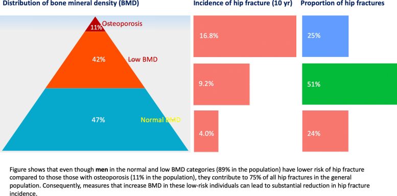 Distribution of Bone Mineral Density and Hip Fracture