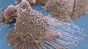 Dividing Cancer Cells