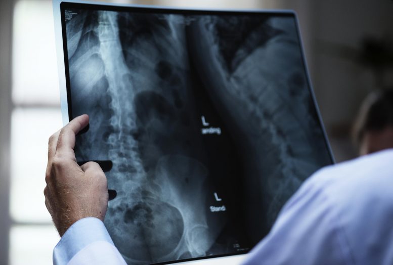 Doctor Examines Bones X Ray