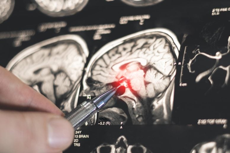 Doctor Examines Human Brain X-Ray Disease Treatment
