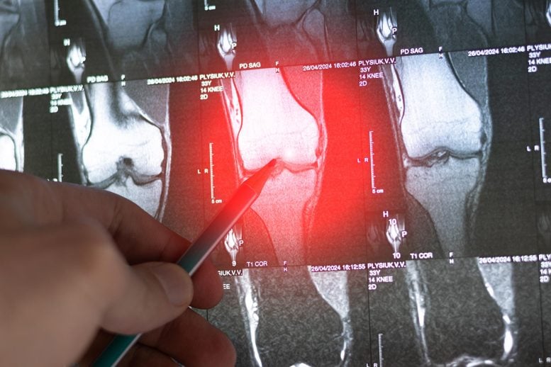 Doctor Examining Bone Knee Tumor X Ray