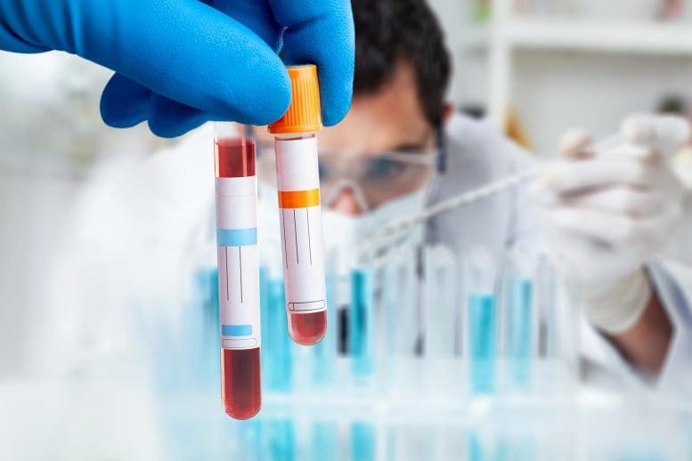 Doctor Holding Blood Sample Test Tube