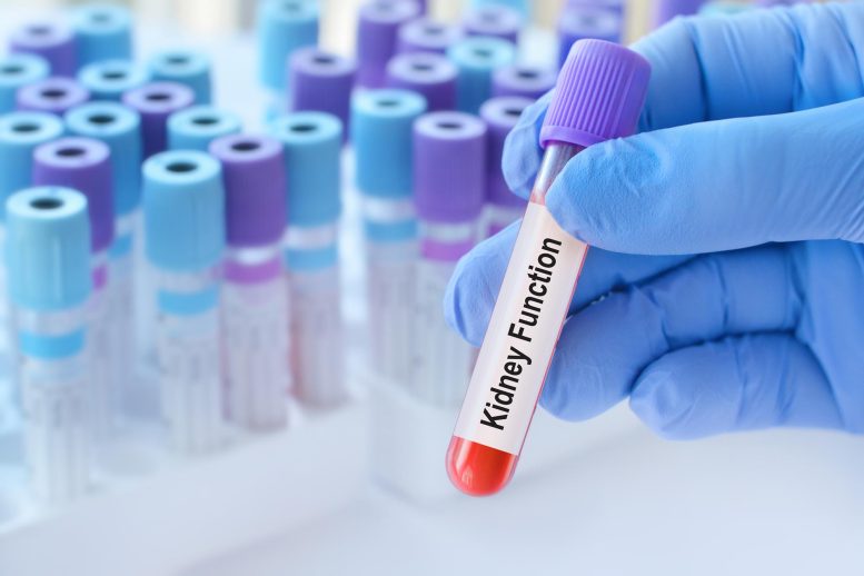 Doctor Holding Kidney Function Blood Test Tube