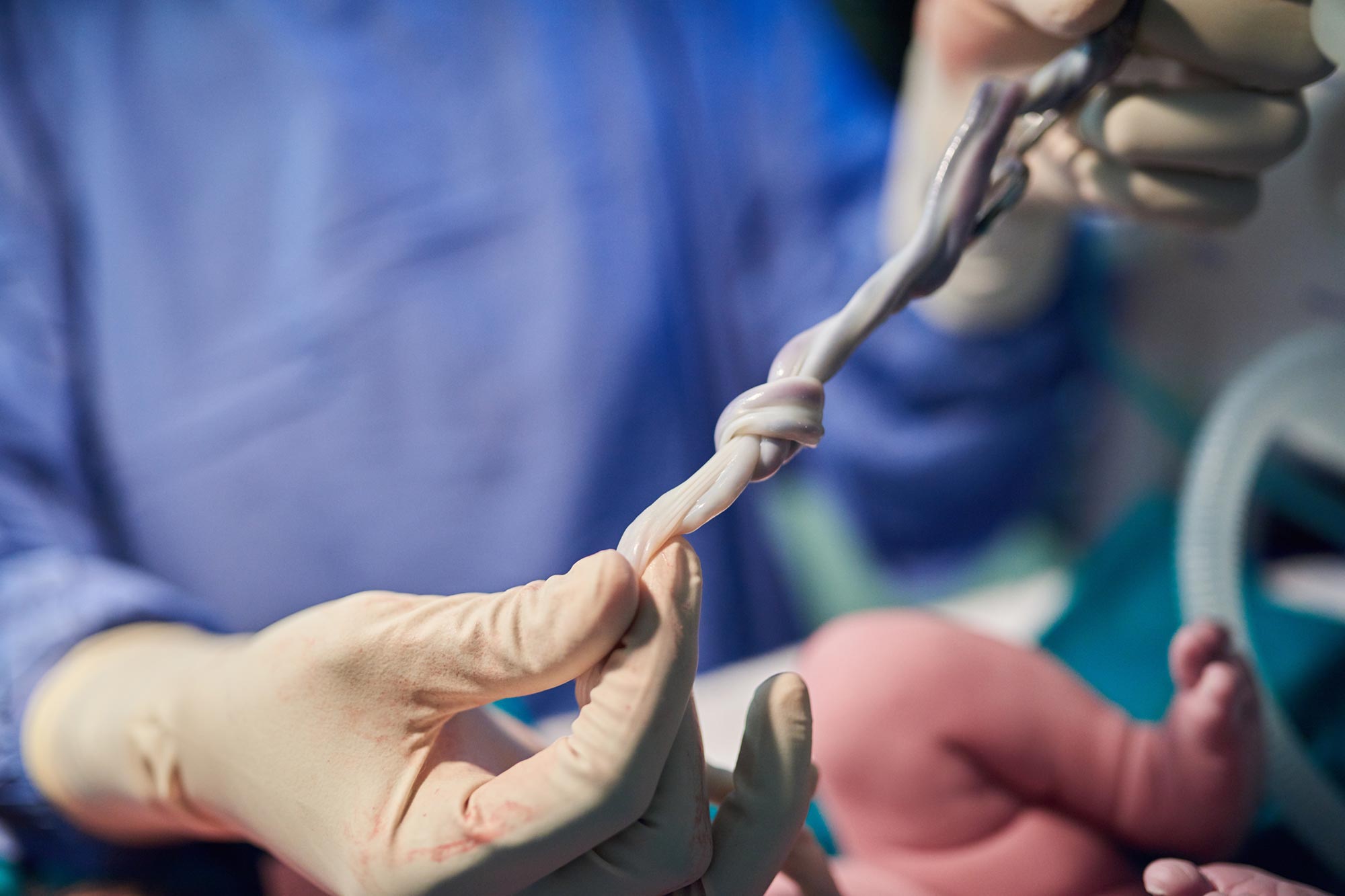 Image of the Scientists Just Discovered Something Alarming in Umbilical Cord Blood - SciTechDaily news article