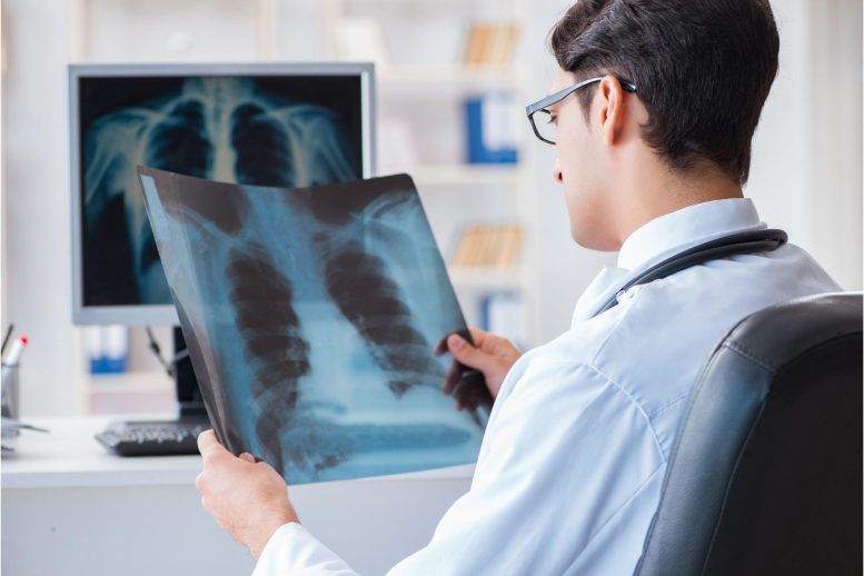 Doctor Looking at X Ray Scans Lungs