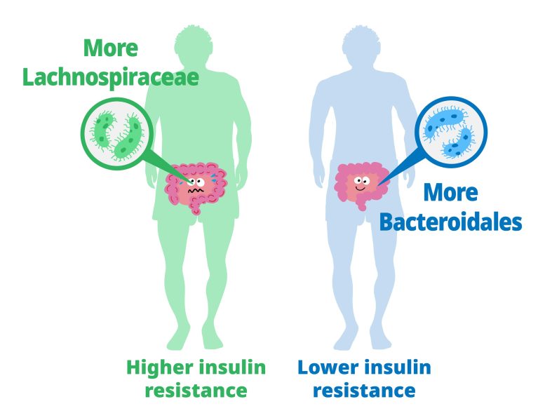 Dominant Gut Microbiota Impact Insulin Resistance