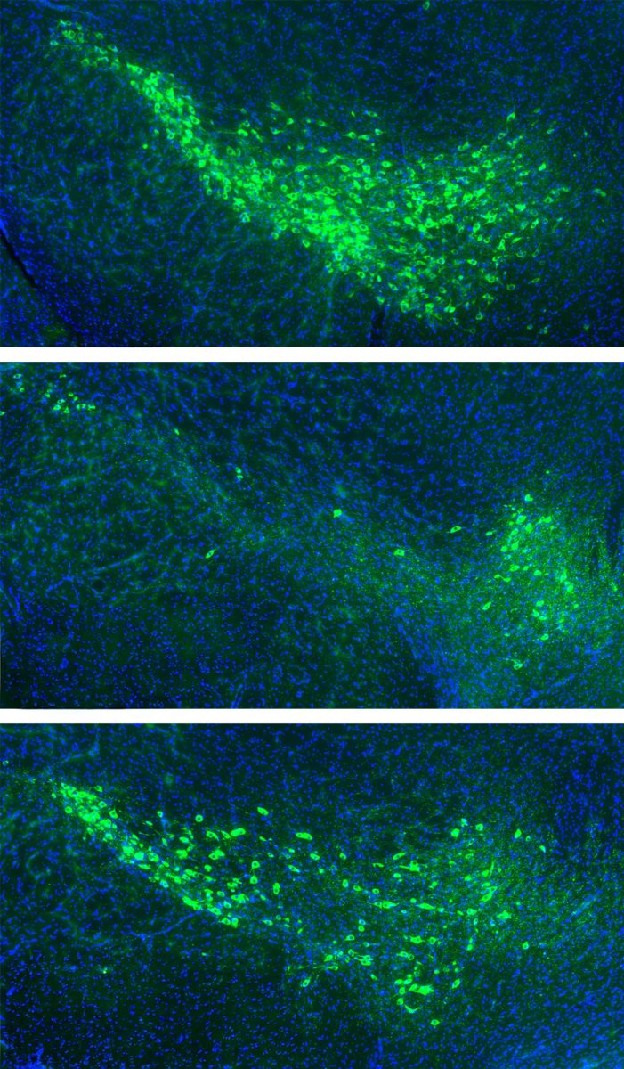 Dopamine Neuron Degeneration and Protection in Mice