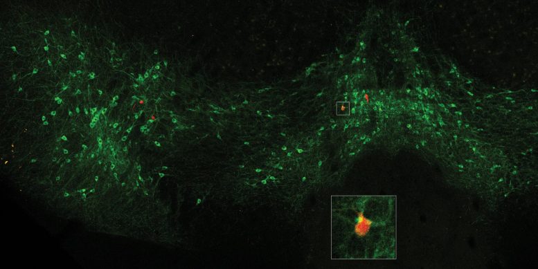 Dopamine Neurons Connection